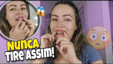 COMO RETIRAR O APARELHO MÓVEL!!!