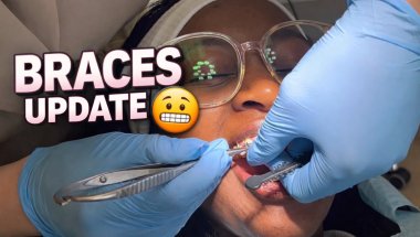 BRACES UPDATE😬 / New colours / Am I blind ? || My braces journey