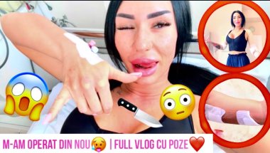 ❤️Liposucție la Brațe😱|Toată Experiența Mea🔪😳 Ziua 1–7💉➡️💪