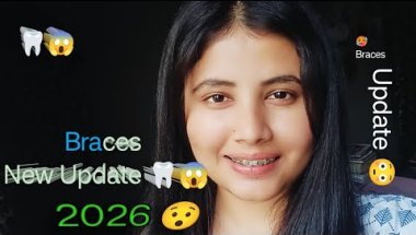 New Braces Update..🦷😱 || #bracesupdate #bracesjourney #teethextraction 🦷😳👀