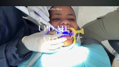 VLOG: I Finally Got Braces! First Day Experience 🥵 | My Honest Reaction 🤦‍♂️