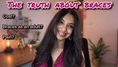 The Truth about braces 😬  (Invisalign VS Braces)