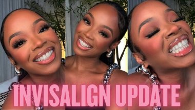 I'm FINALLY DONE with Invisalign! My 14 Year Teeth Journey | Invisalign | Braces & Final Results