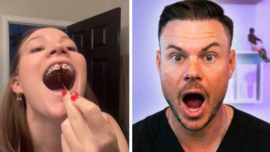 This Teeth Situation is Insane