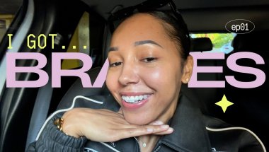 getting braces... again at 32 | perfect smile journey ep.1
