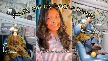 Got Braces On My Bottom Teeth | 7 Month Braces Update 🦷✨