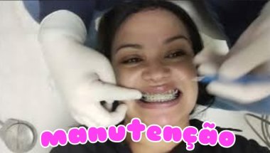 Vlog: DIA DE MANUTENÇÃO ODONTOLÓGICA | Extrema mg| POLIANA BERNARDO #dentist