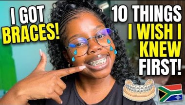 ‼️🇿🇦😭I REGRET BRACES?! The Truth no-one tells you| #ADULTBRACES🇿🇦
