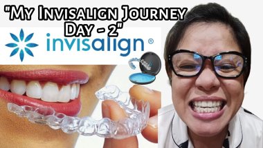 My Invisalign Journey: Day 2 & 3 Adjusting to the Pressure & New Routines | Tagalog