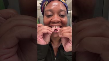 Day 4 #Invisalign