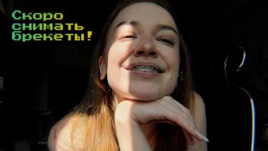 Болтаем! Спустя 3 года лечения - скоро снимать брекеты!