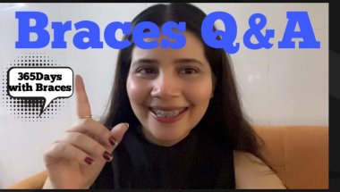 Braces Q&A full update/Cost/duration/pain#viral #trending #teeth #youtuber #dentalcare #toptrending