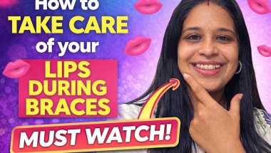 My Secret Lip Care Routine During Braces ✨#braces care # braces vlog #real