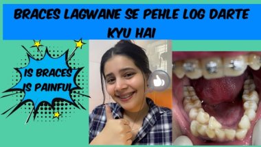 Braces lagwane se pehle log darte kyu hai?#viral #dentist #trending #youtube #toptrending #teeth