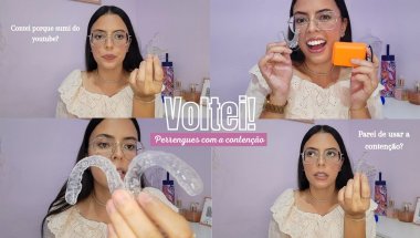Meu Aparelho Móvel + BATE PAPO 😁🦷✨️| contei tudo! - SARA SILVA