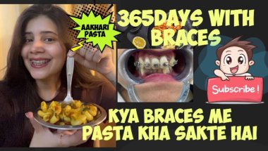 My braces journey with Pasta#viral #dentist #trending #dentalcare #youtube #toptrending #transforma