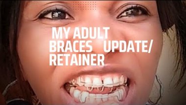 My Adult Braces Update!#How  To fixed My RETAINER.