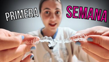 MI PRIMERA SEMANA CON ALINEADORES INVISIBLES | LA REALIDAD