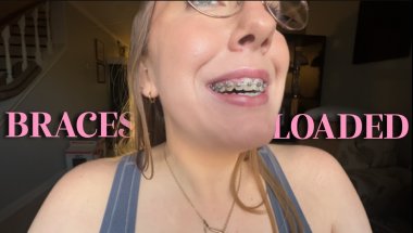 braces loaded: 6 weeks in, sick, and three weeks from next appointment