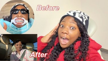 GETTING BRACES FOR THE FIRST TIME !!
