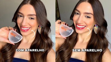 SOUSMILE VALE À PENA? MEU ANTES E DEPOIS + SE OS ALINHADORES INVISÍVEIS REALMENTE FUNCIONAM?