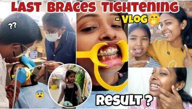 😭❤️🦷Yaadgar Braces tightening rahegi || Struggle for Smile 2026 | Miss Archu Vlogs 🪷✨