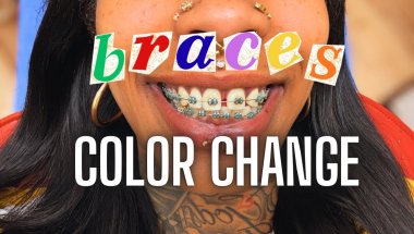 GETTING MY BRACES COLOR CHANGED 😍😍