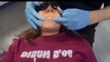 Come With Me To Get My Braces Removed!! 😁😁😁