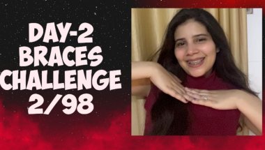 Day2 braces challenge #viral #dentist #trending #dentalcare #teeth