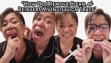 How to Remove,Clean, & Reinsert the Invisalign Trays | My Invisalign Journey