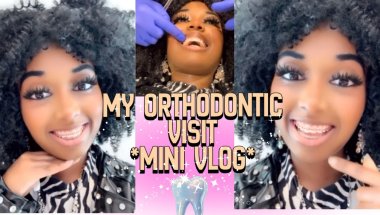 SHOULD I BE WORRIED? 😬 | Orthodontist Tightening Update
