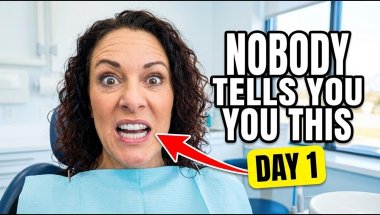 I Just Got My Invisalign Fitted, Here’s What Nobody Tells You