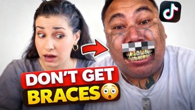 Don’t get braces unless you’re ready for this!!