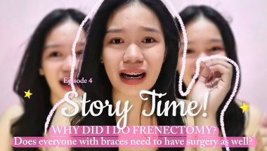 Before You Get a Frenectomy… WATCH THIS! (My Real Experience)