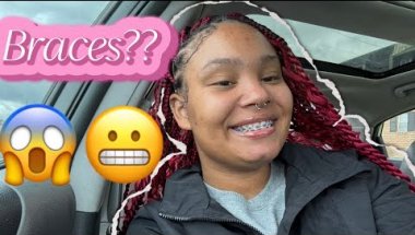 My Braces Journey Starts Now😬! #viralvideo #braces #subscribe