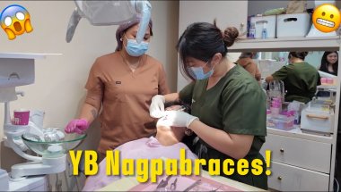 NAGPABRACES SI YEAHBERT!