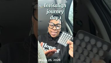 Invisalign journey day,1