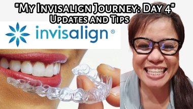 My Invisalign Journey: Day 4 Updates and Tips | Tagalog
