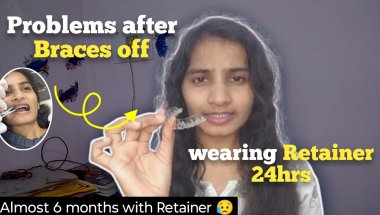 Problem I am facing after Braces off 😩