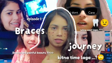 🦷😱Why I Started My Braces Journey|| My Braces Journey||2026 Braces Journey update@Giinuartgallery270
