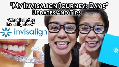 "My Invisalign Journey: Day 5" Updates and Tips | What is in the Invisalign box? | Tagalog