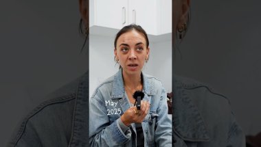 Braces and Jaw surgery - Adult Patient Journey!