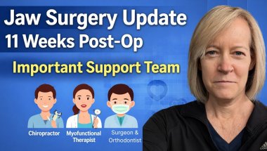 11 Weeks Post-Op Update: Loose Teeth, TMJ... STRONG SUPPORT TEAM