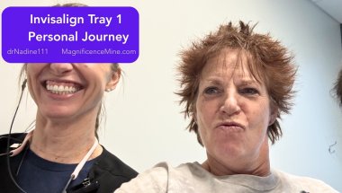 Nadine_Invisalign Personal Journey_Tray 1