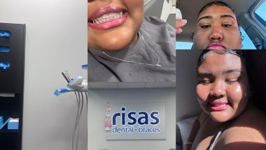 Getting my braces off After 3 years😩|| i cried!