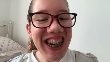Braces journey!