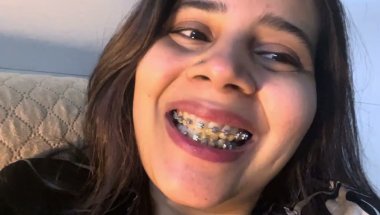 Braces lgane ke baad demotivate feel kr rahi hu#viral #smiledesigndental #youtube #trending#dentist