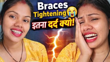 Braces Tightening Experience 😫 | Pain + Funny Reaction 😂