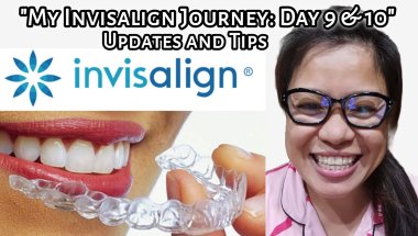"My Invisalign Journey: Day 9 & 10" Updates and Tips | Tagalog