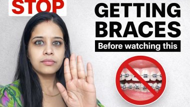 STOP Before Getting Braces 😱 | Truth You Must Know Before Braces Journey#stop #real #braces